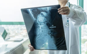 How Mani Ellis & Layne Accident & Injury Lawyers Can Help if You’re the Victim of a Cancer Misdiagnosis in Charleston, WV