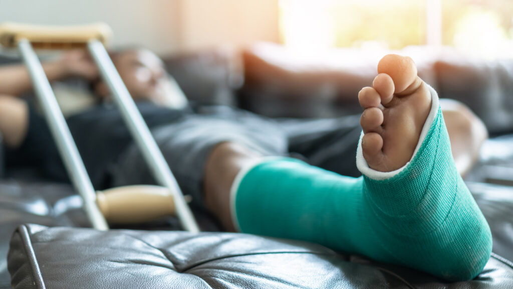 What Happens If I Don’t Fix My Lisfranc Injury?