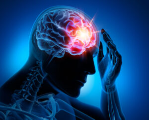 How Mani Ellis & Layne Can Help With Your Child's Neurological Brain Injury Case in Charleston, WV
